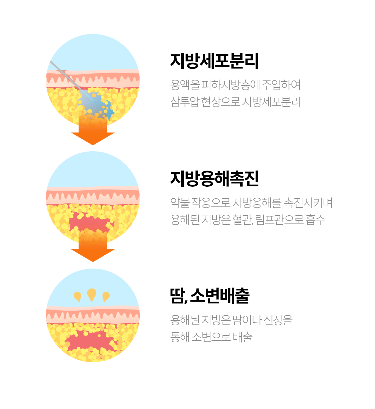 +SLIM 근육 보톡스 톡톡 줄어드는 근육 - 사각턱/바디의 근육에 주사하여 두께와 부피를 줄여 슬림한 라인을 만듭니다.